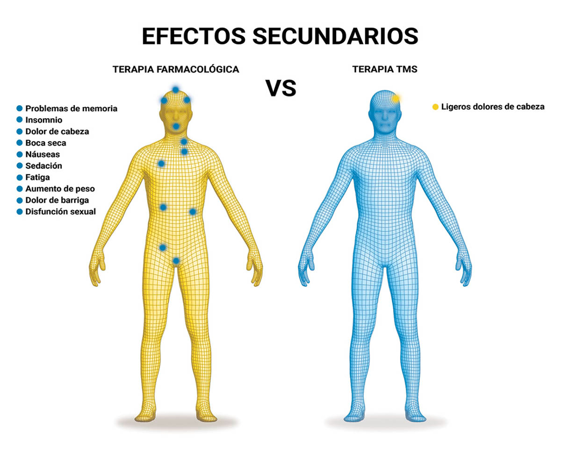 Comparativa de efectos secundarios: Terapias farmacológicas vs. TMS
